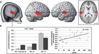 The Neural Correlates of Face-Voice-Integration in Social Anxiety Disorder